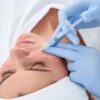 Dermal Fillers